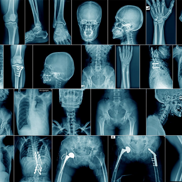 sinha best hospital in bettiah | best gynaecology hospital in bettiah | best laparoscopy hospital in bettiah |